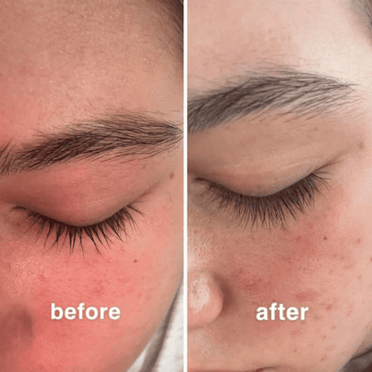 Brillarra™ Eyelash Growth Serum